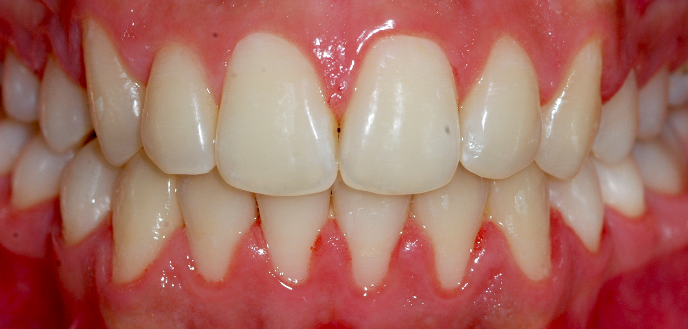 second image