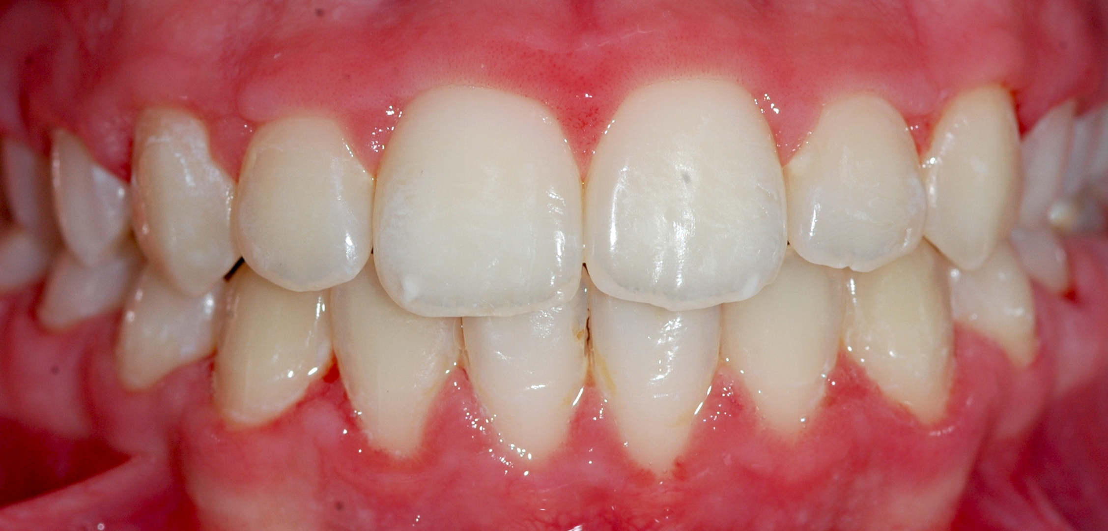 second image