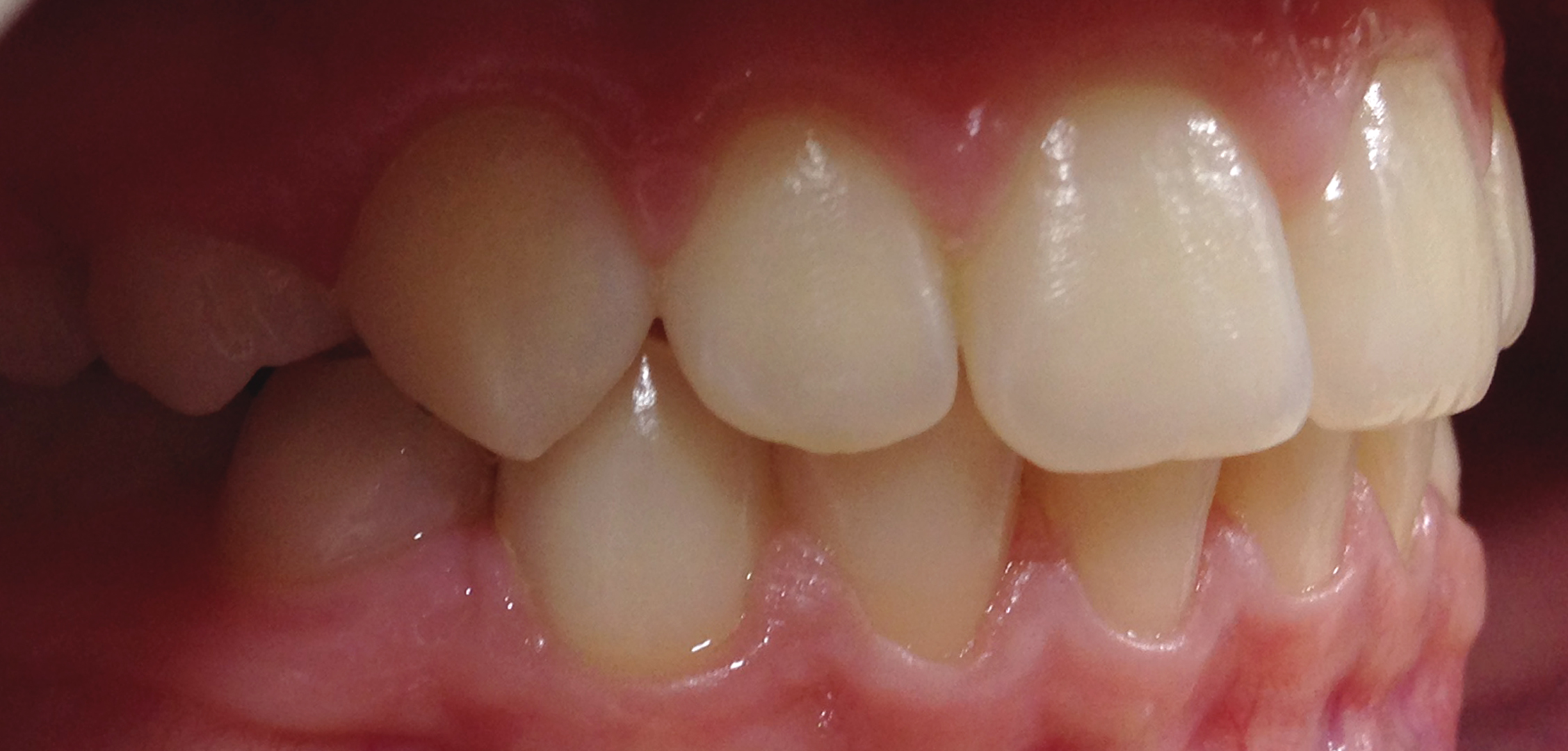 second image