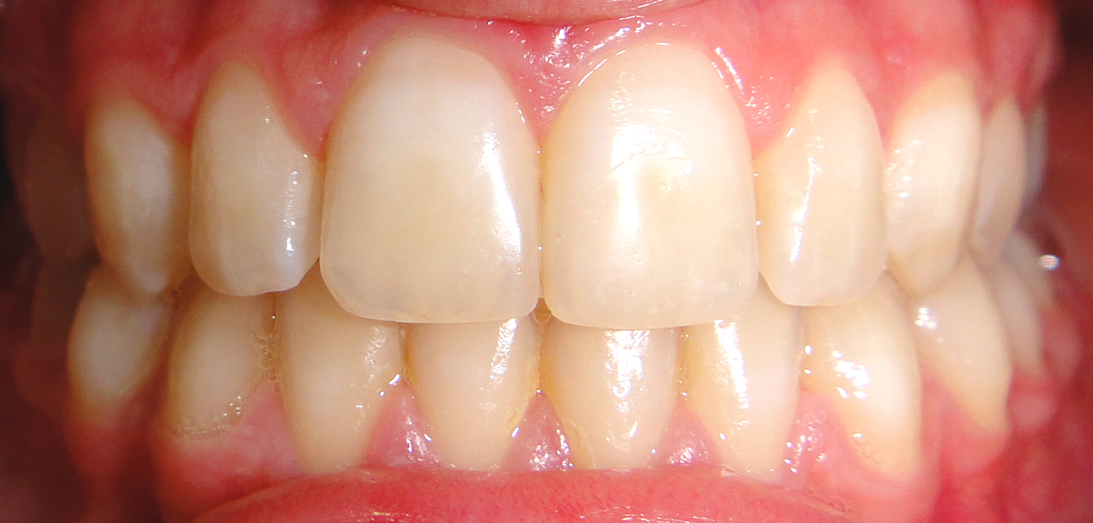 second image