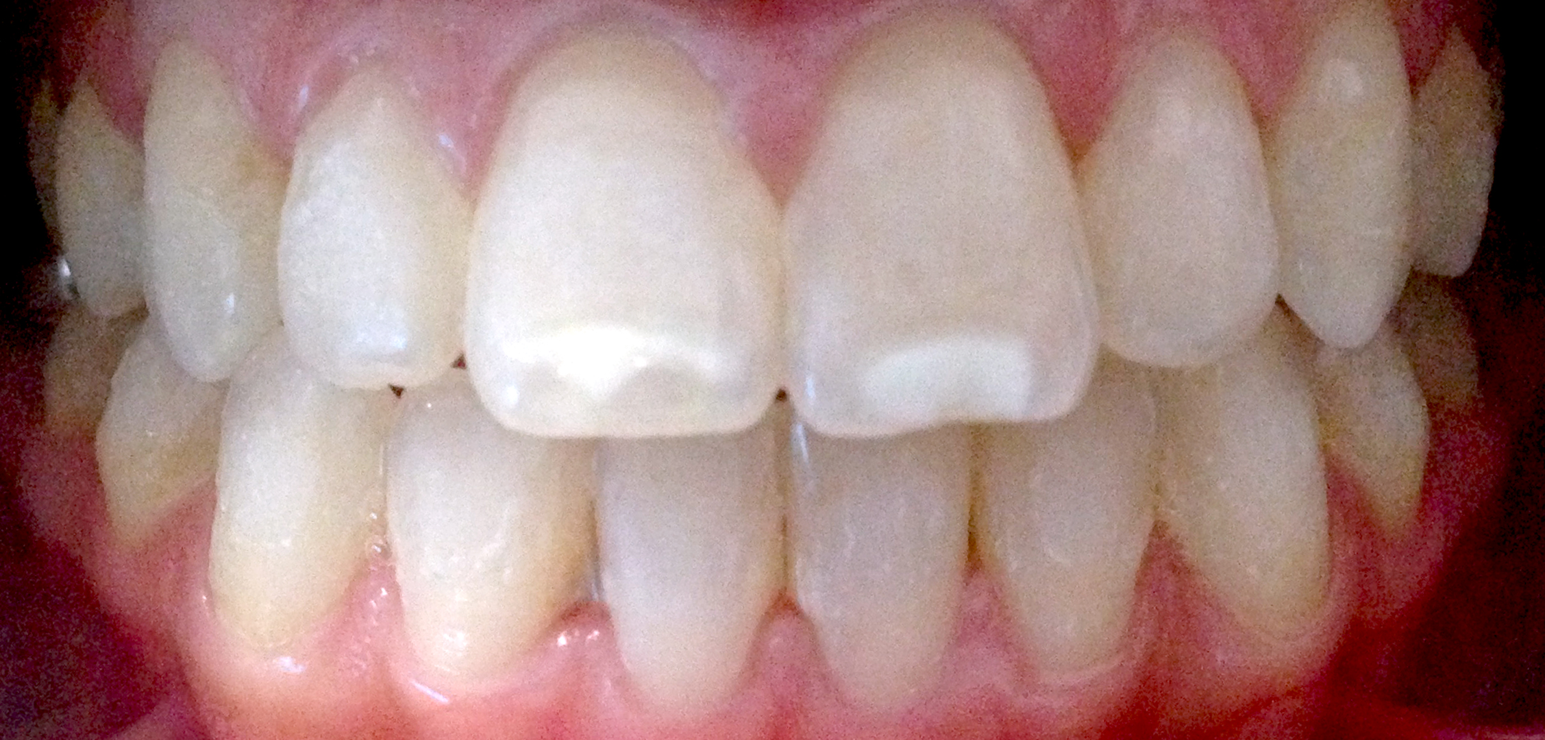 second image