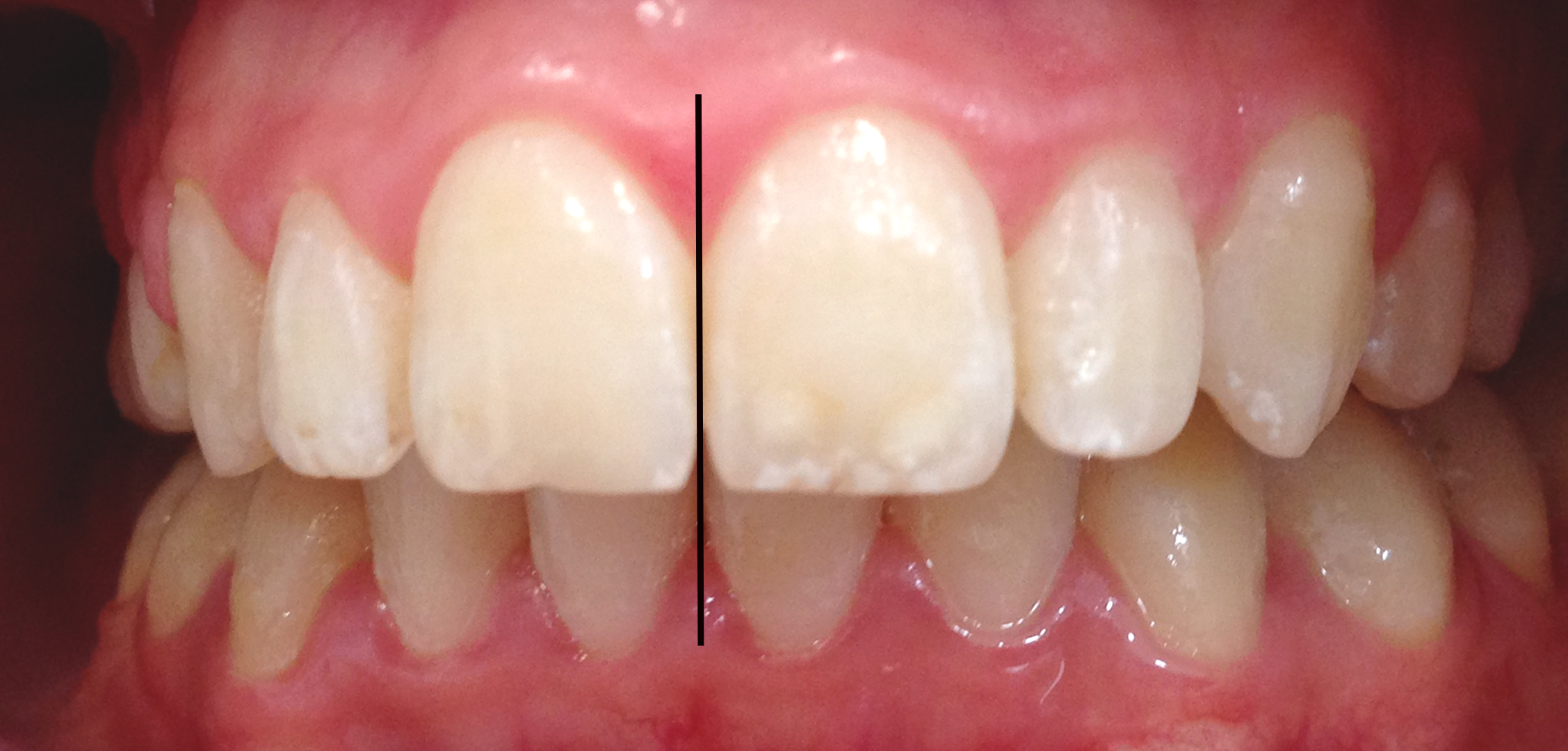 second image