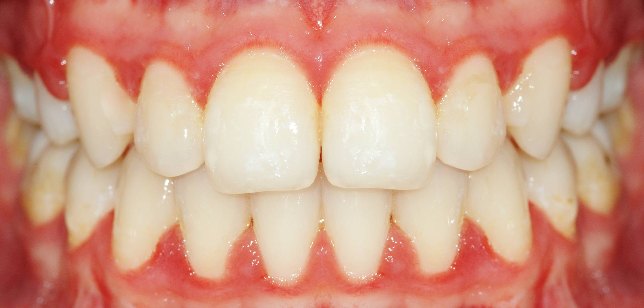second image