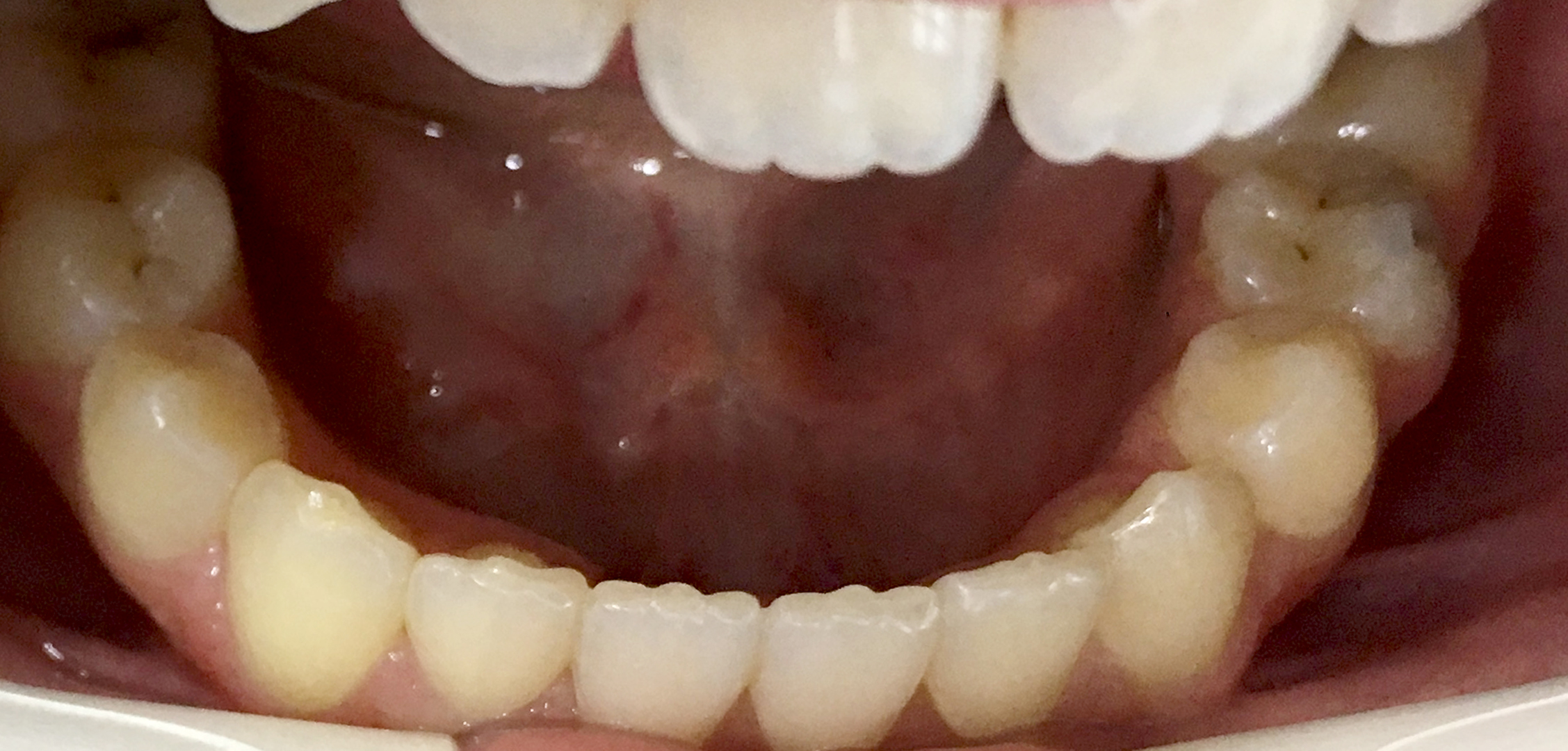 second image