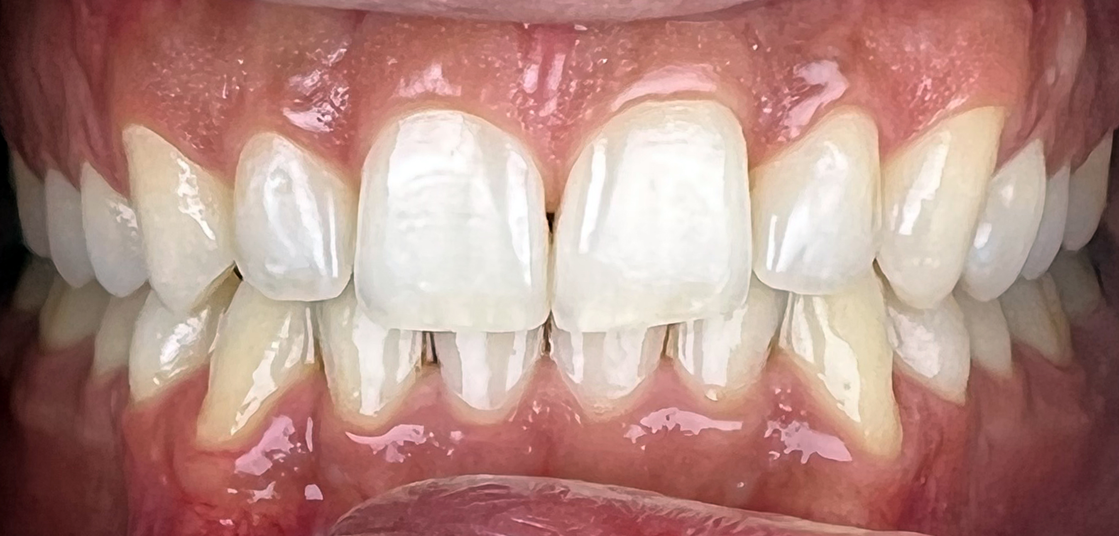 second image