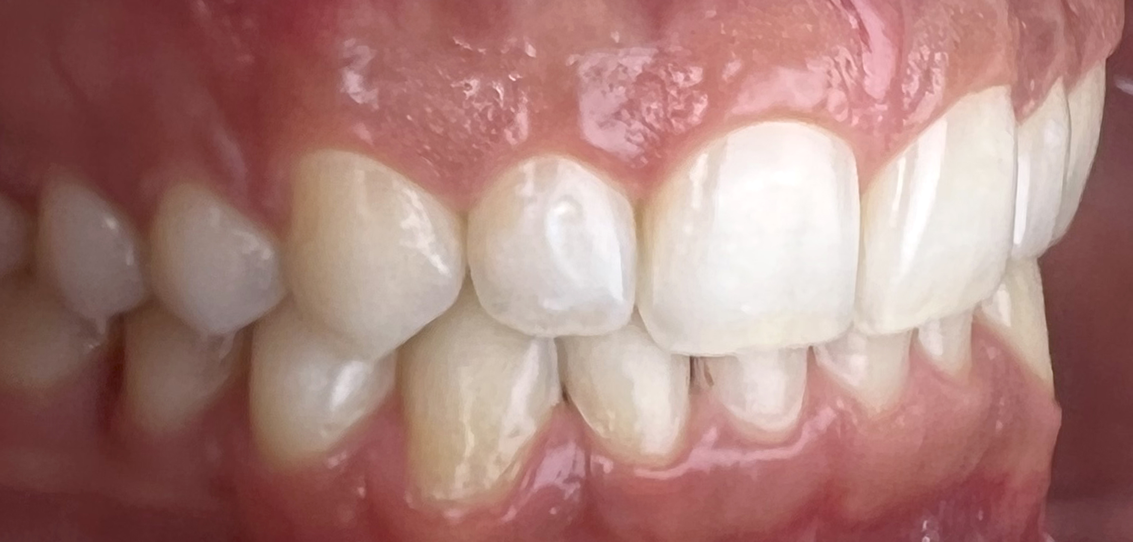 second image