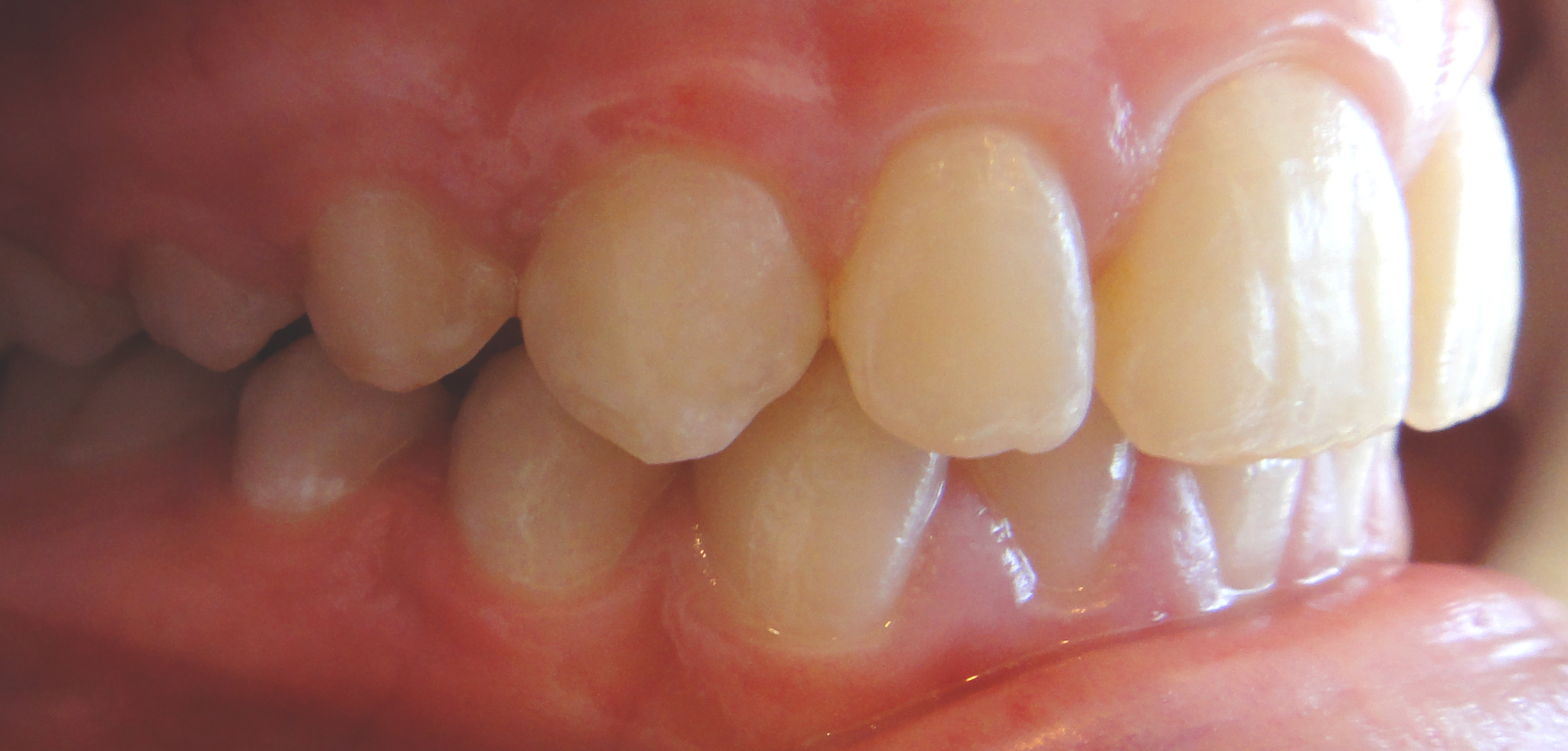 second image