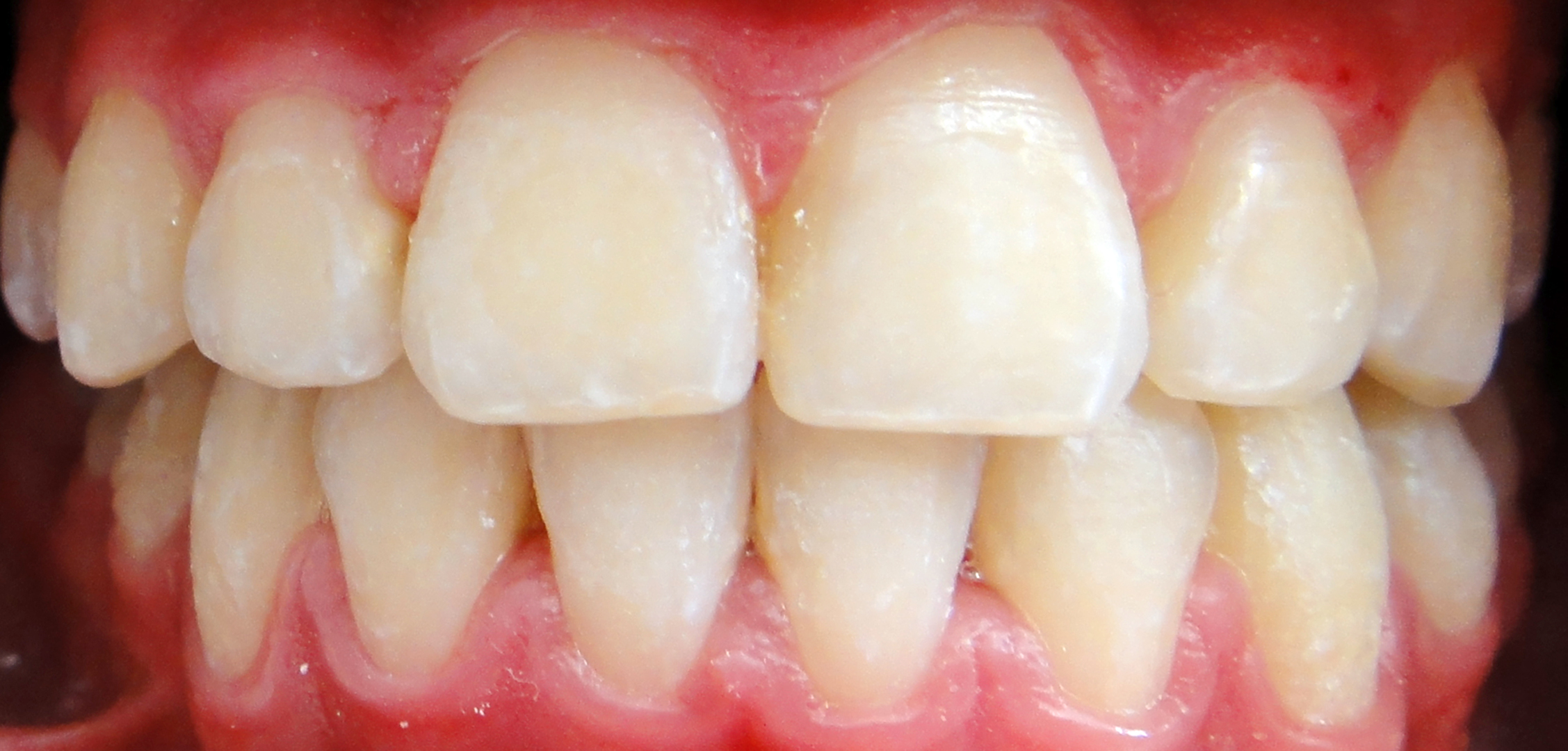 second image
