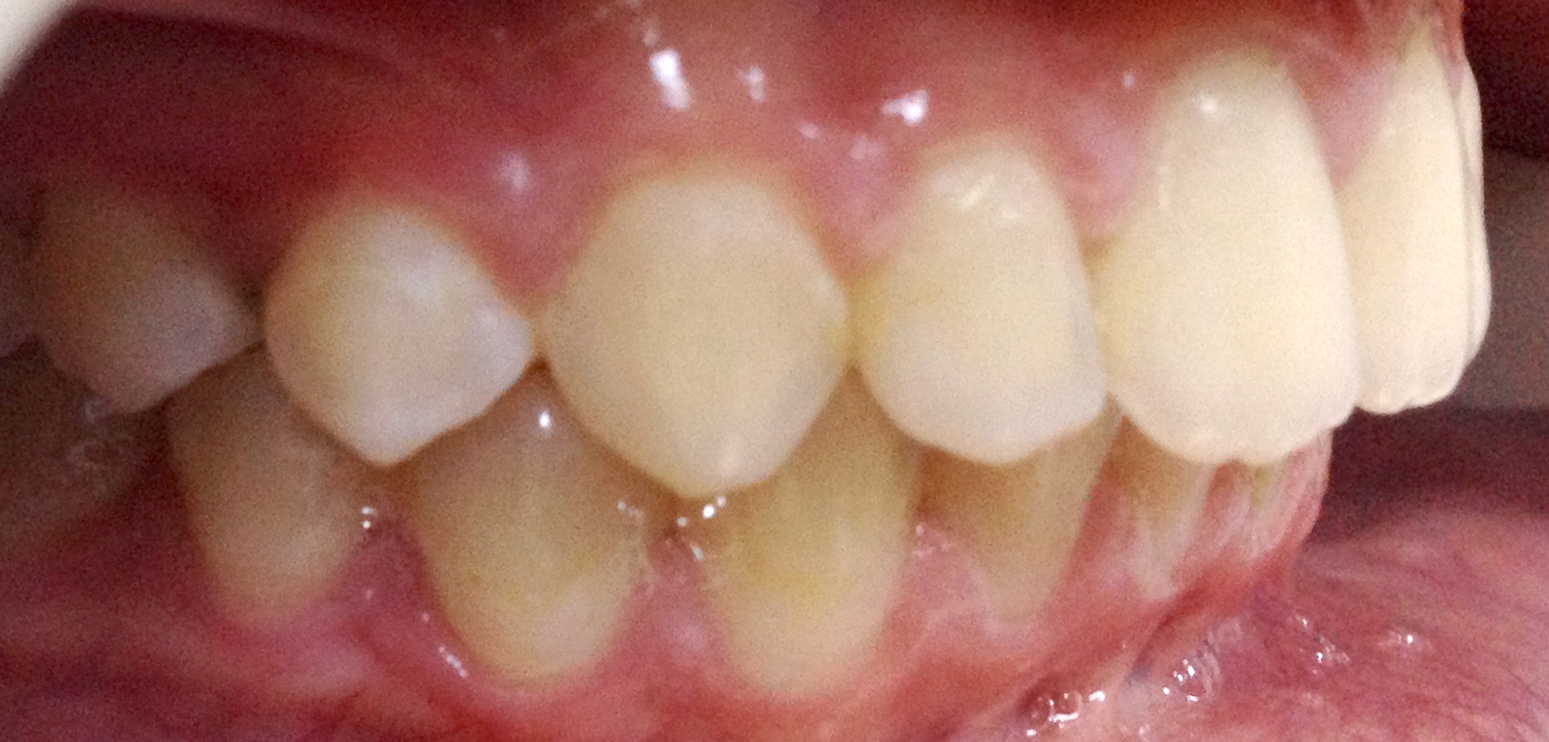 second image