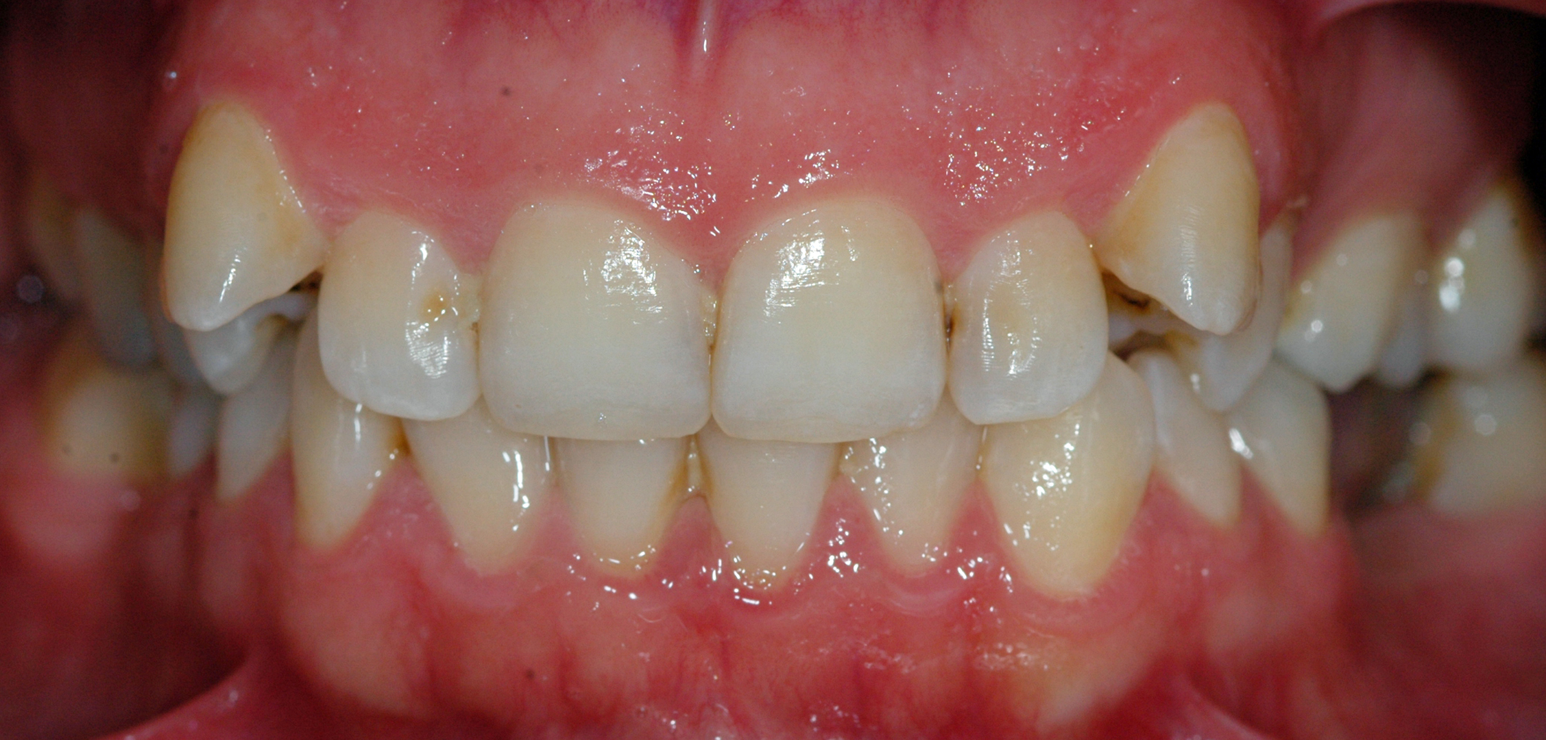 first image