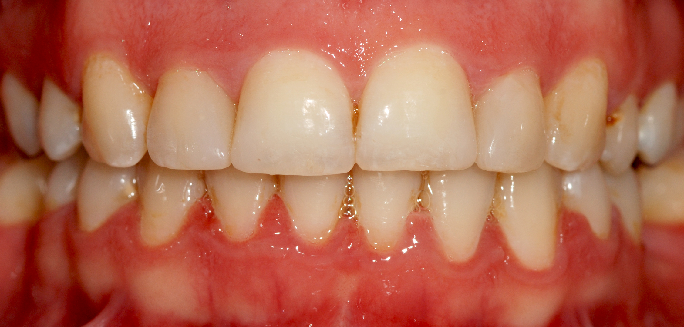 second image