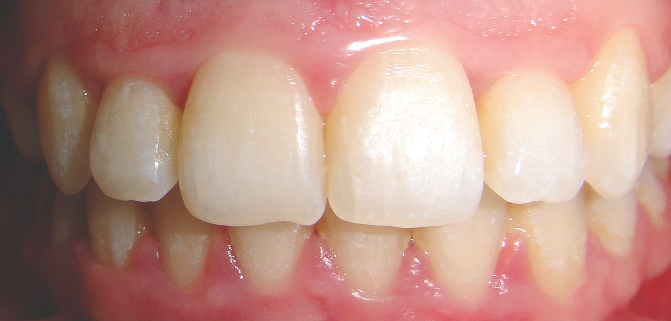 second image