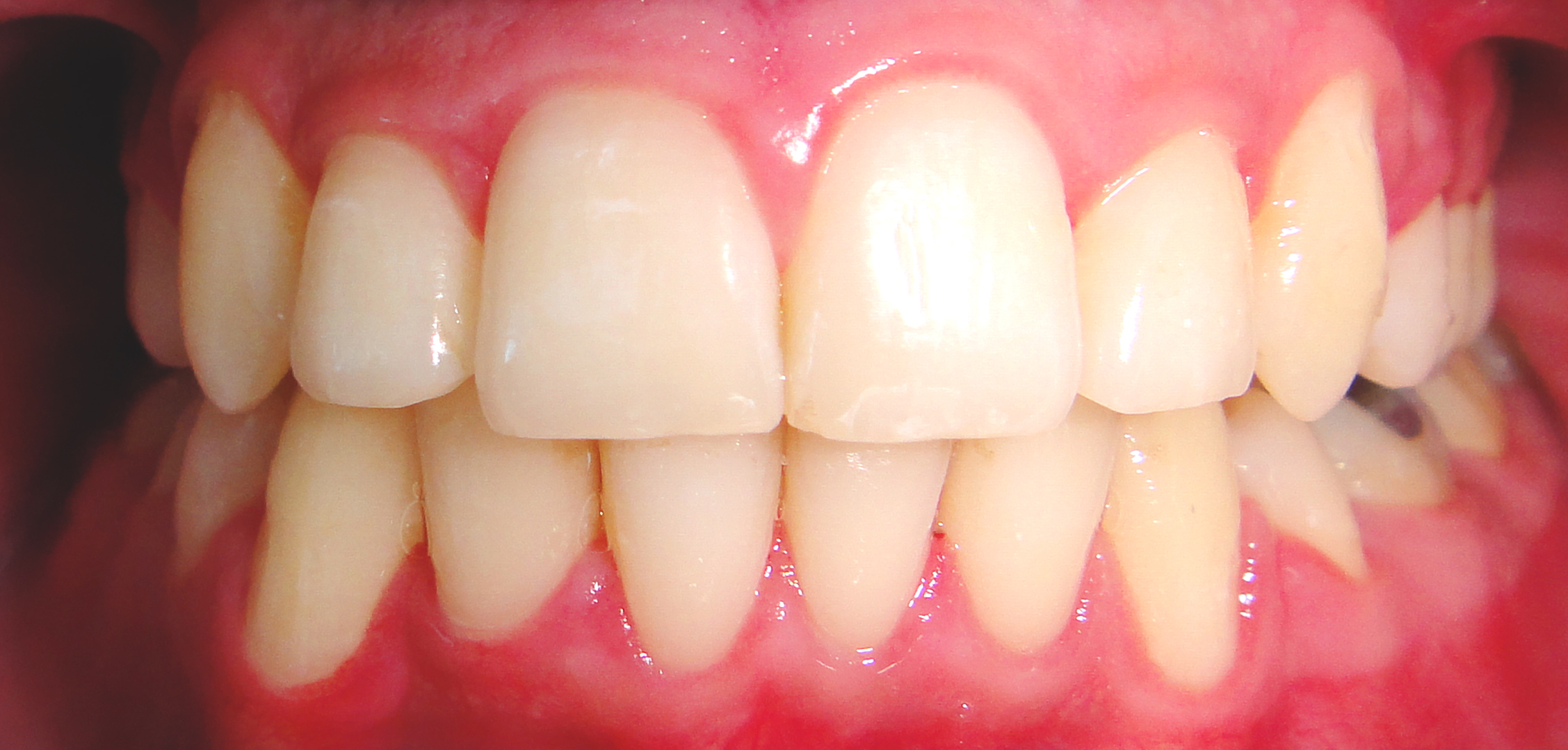 second image