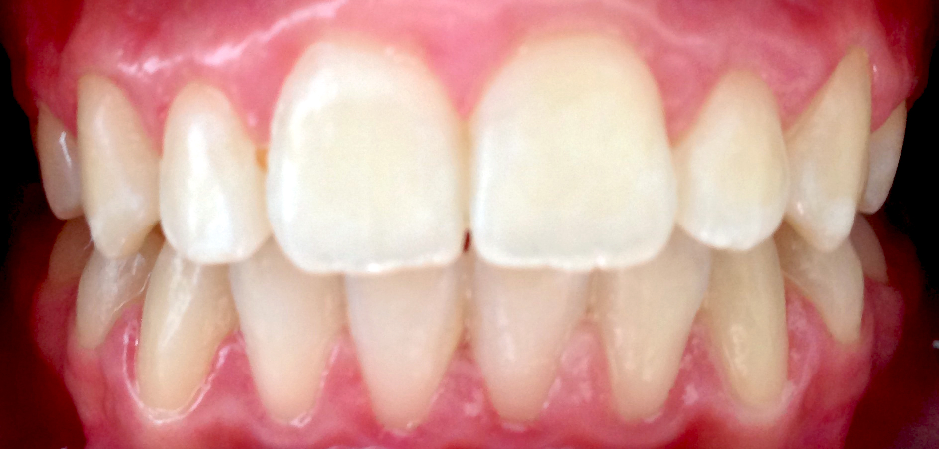 second image