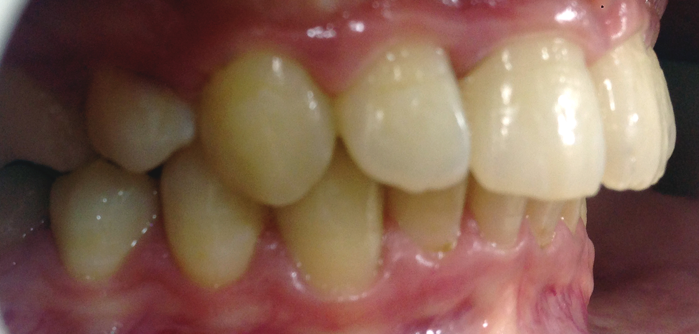 second image