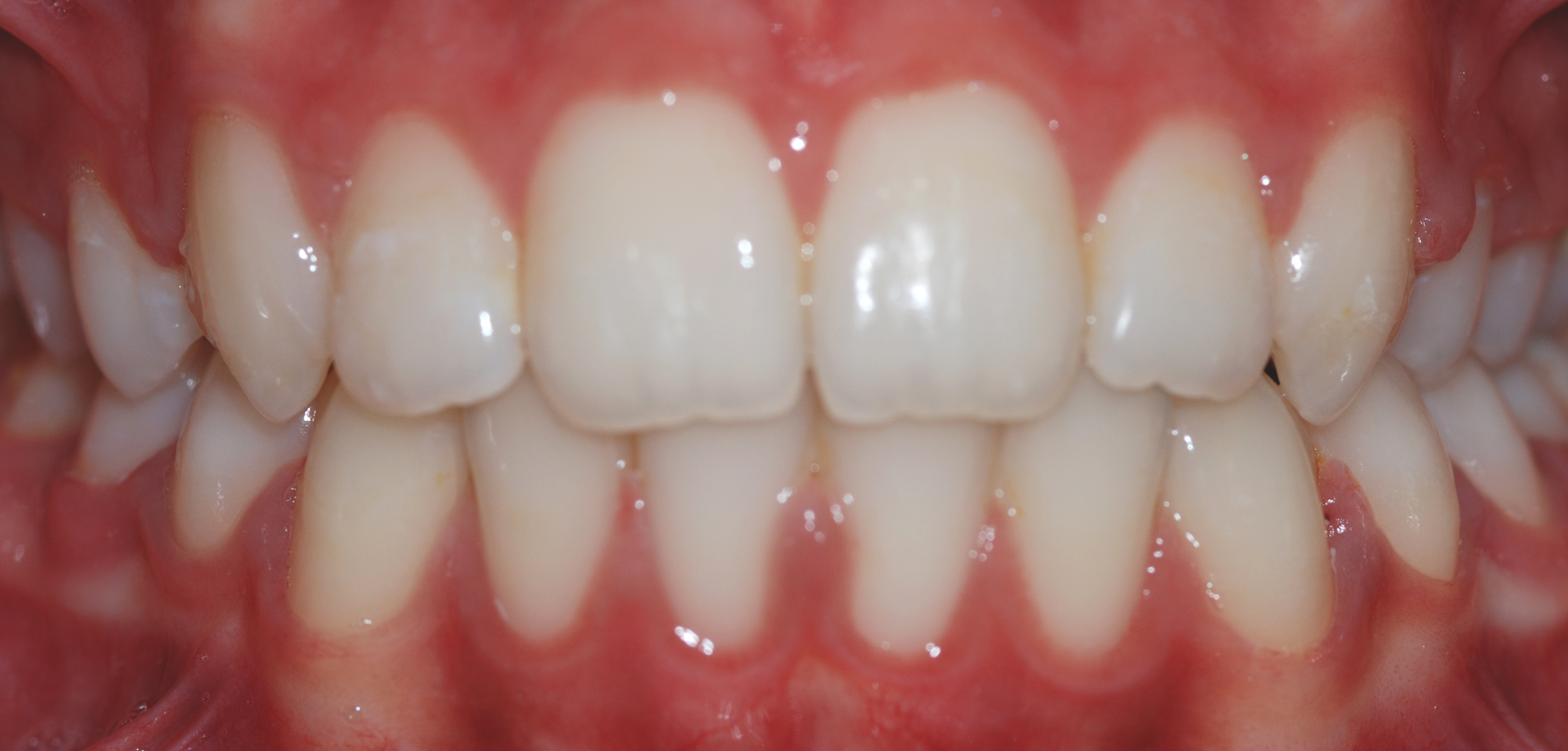 second image
