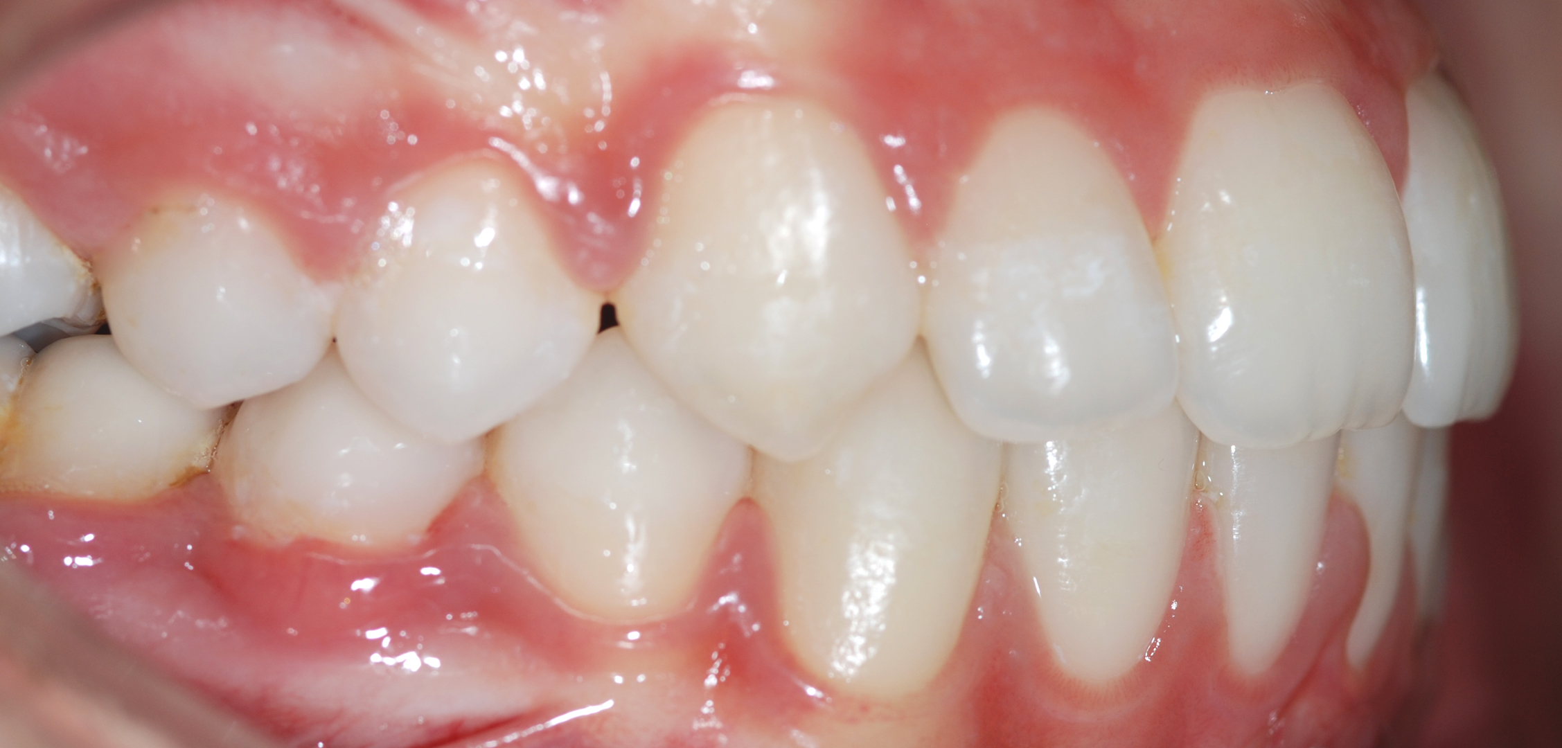 second image