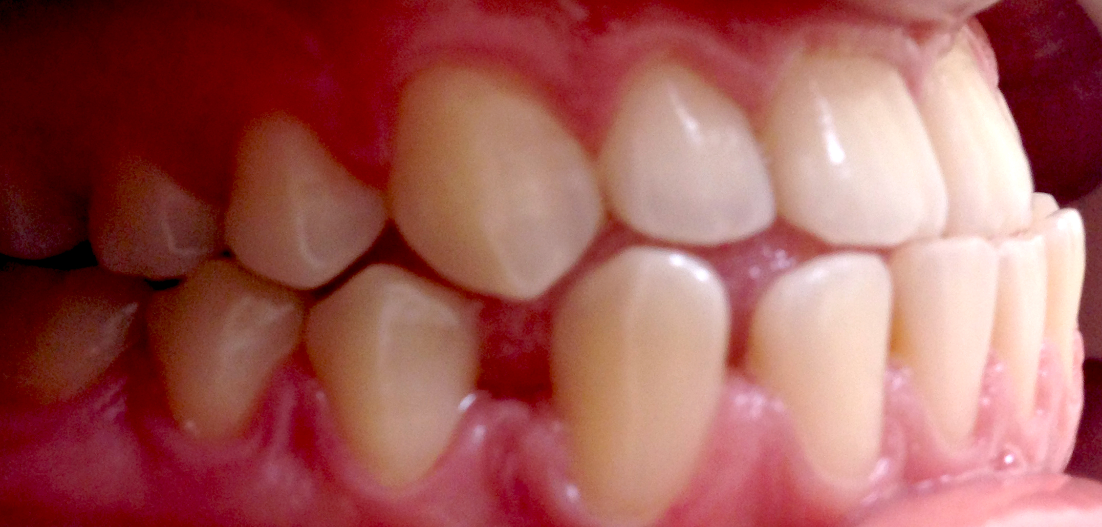 first image