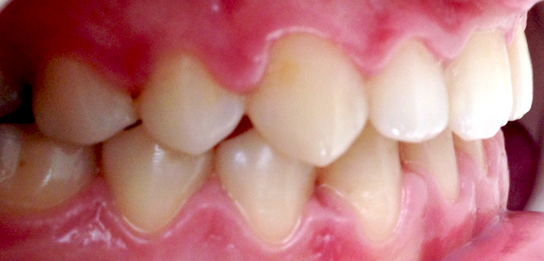 second image
