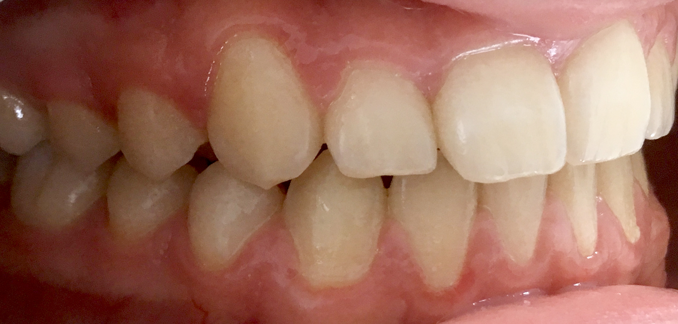 second image
