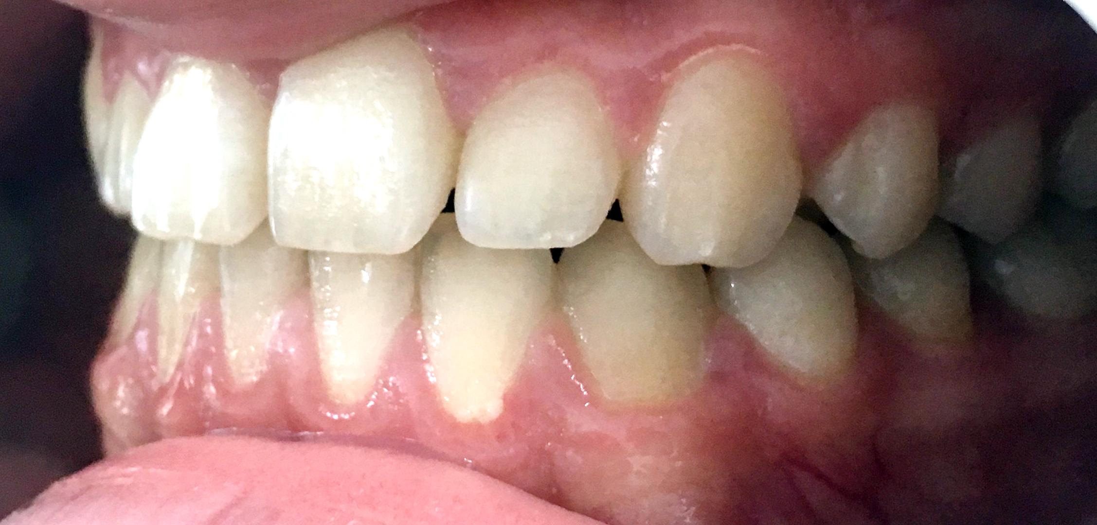 second image