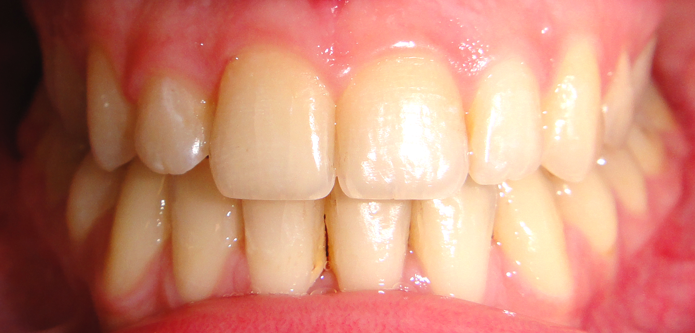 second image