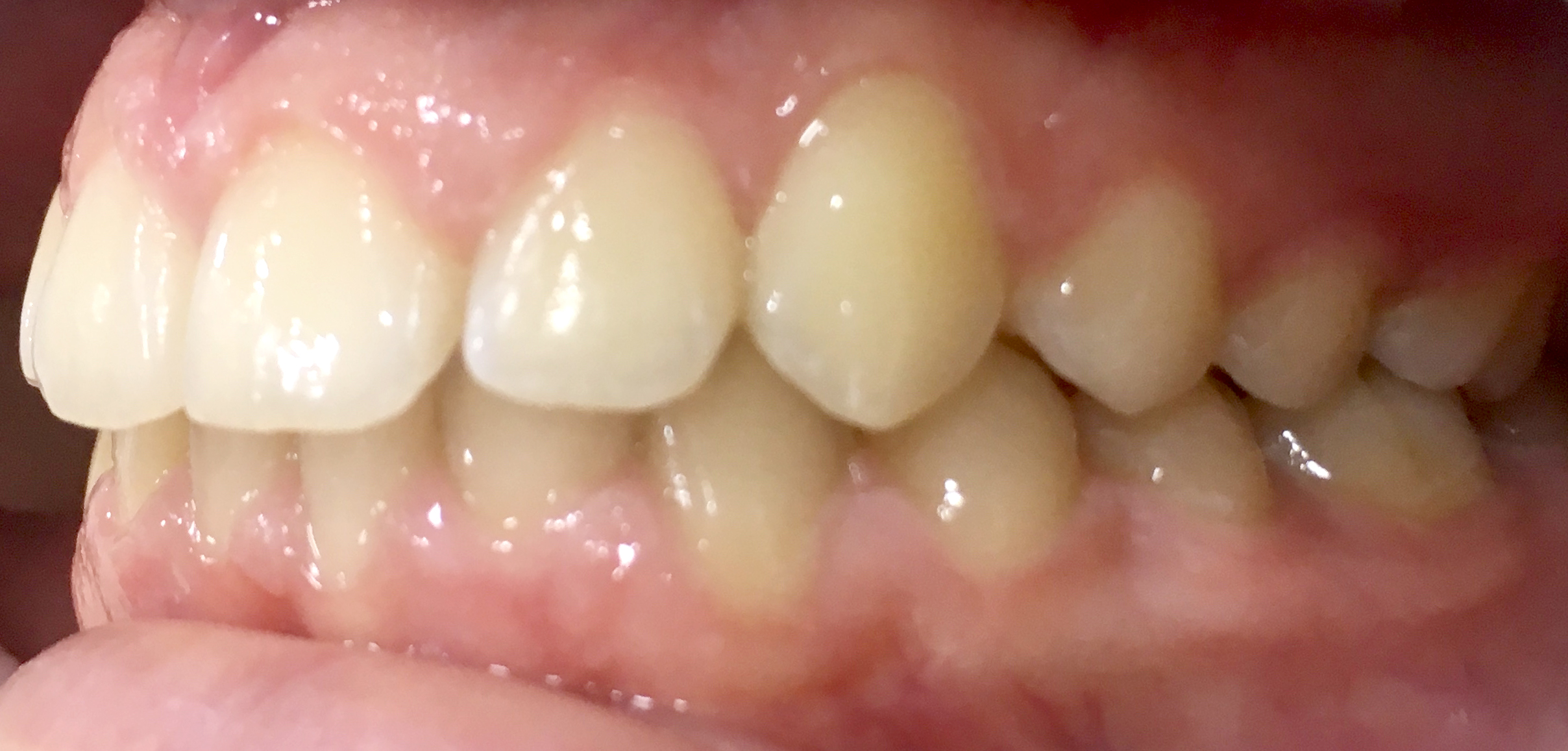 second image