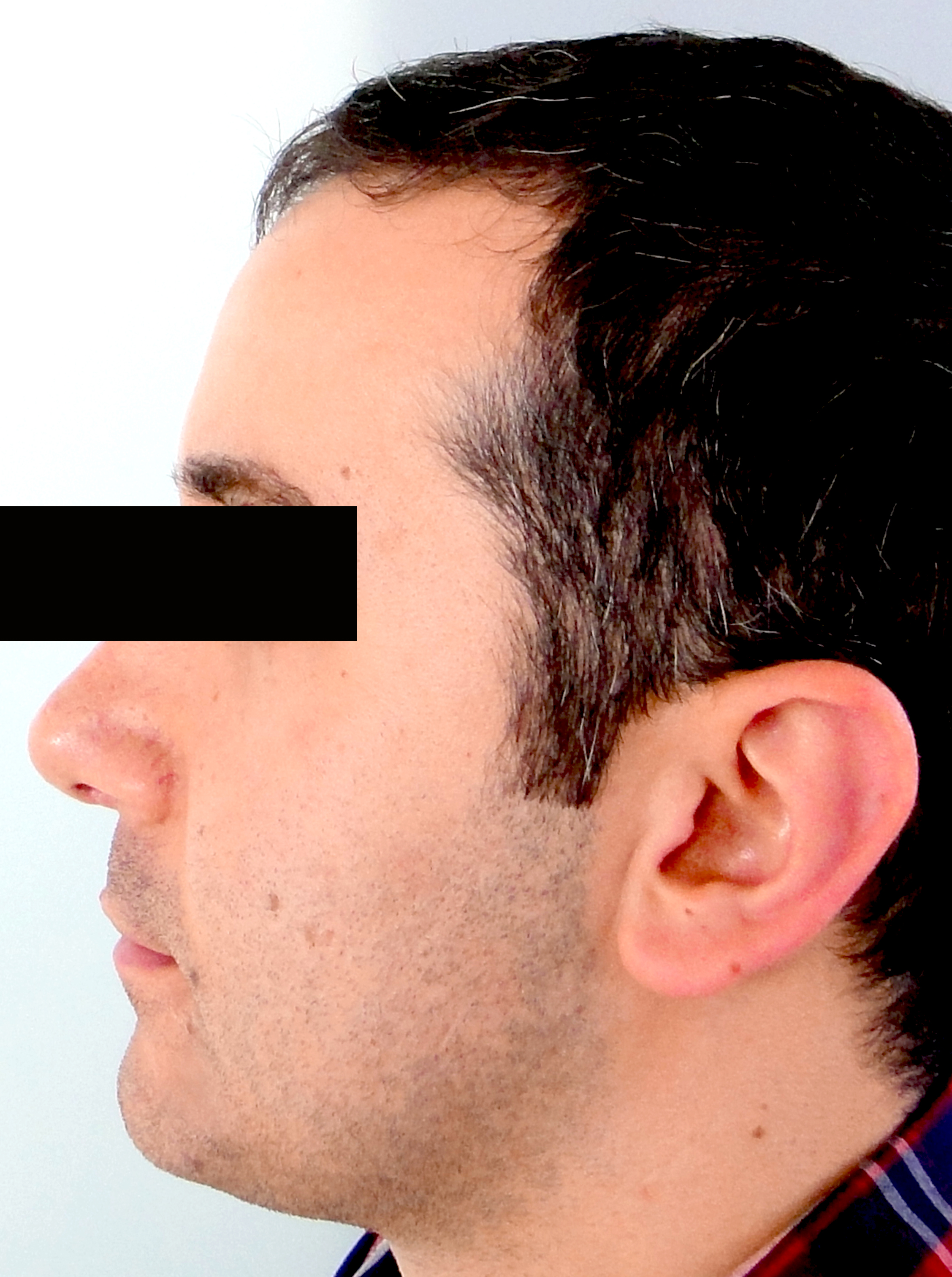 second image