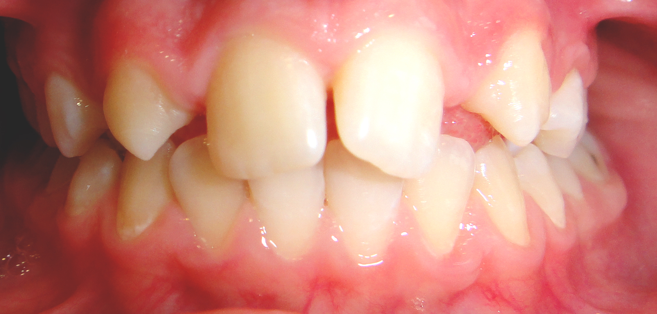 first image