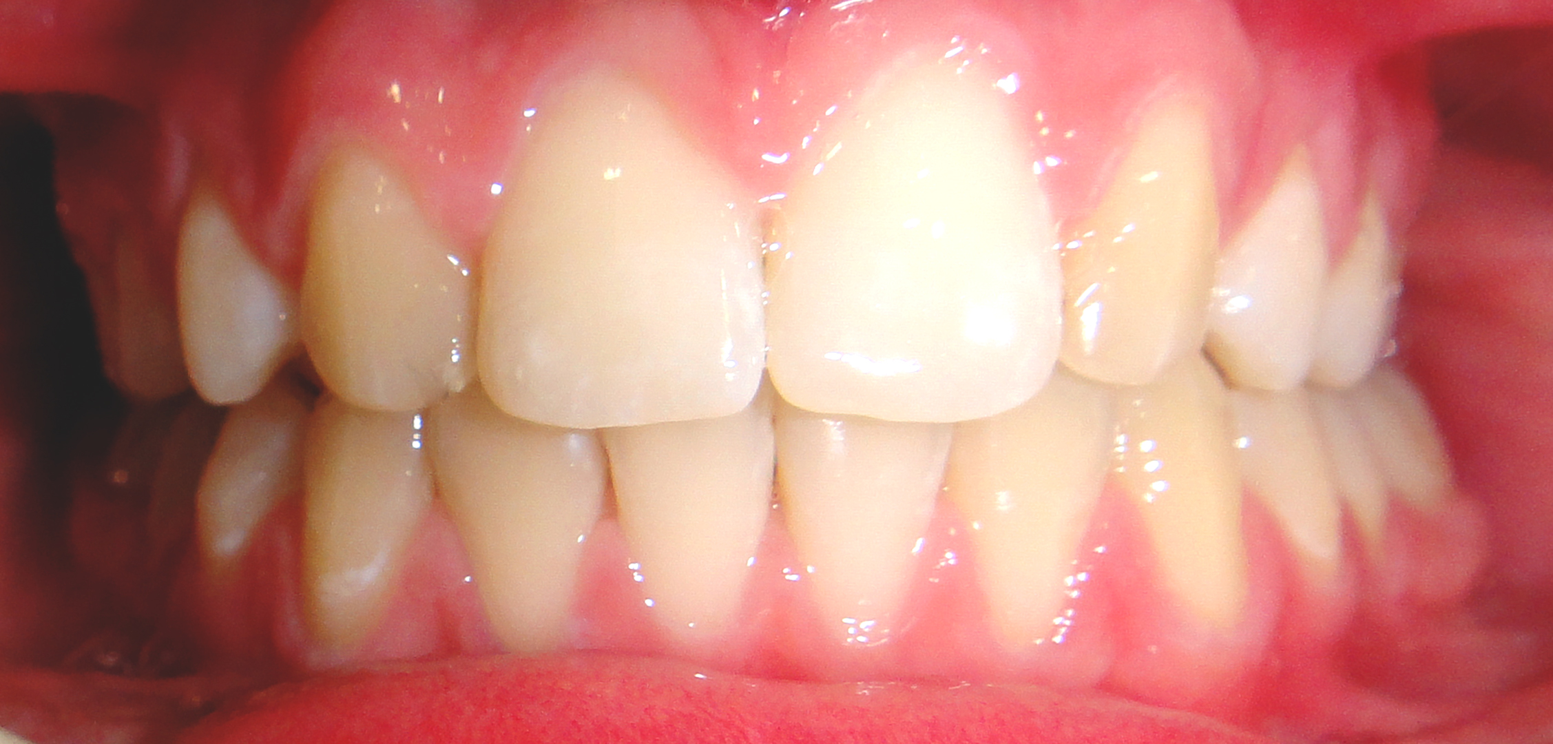 second image