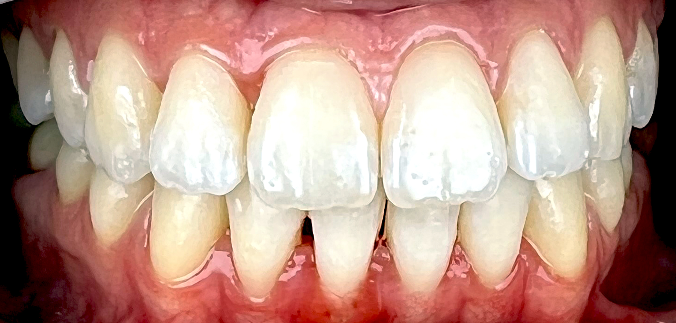 second image