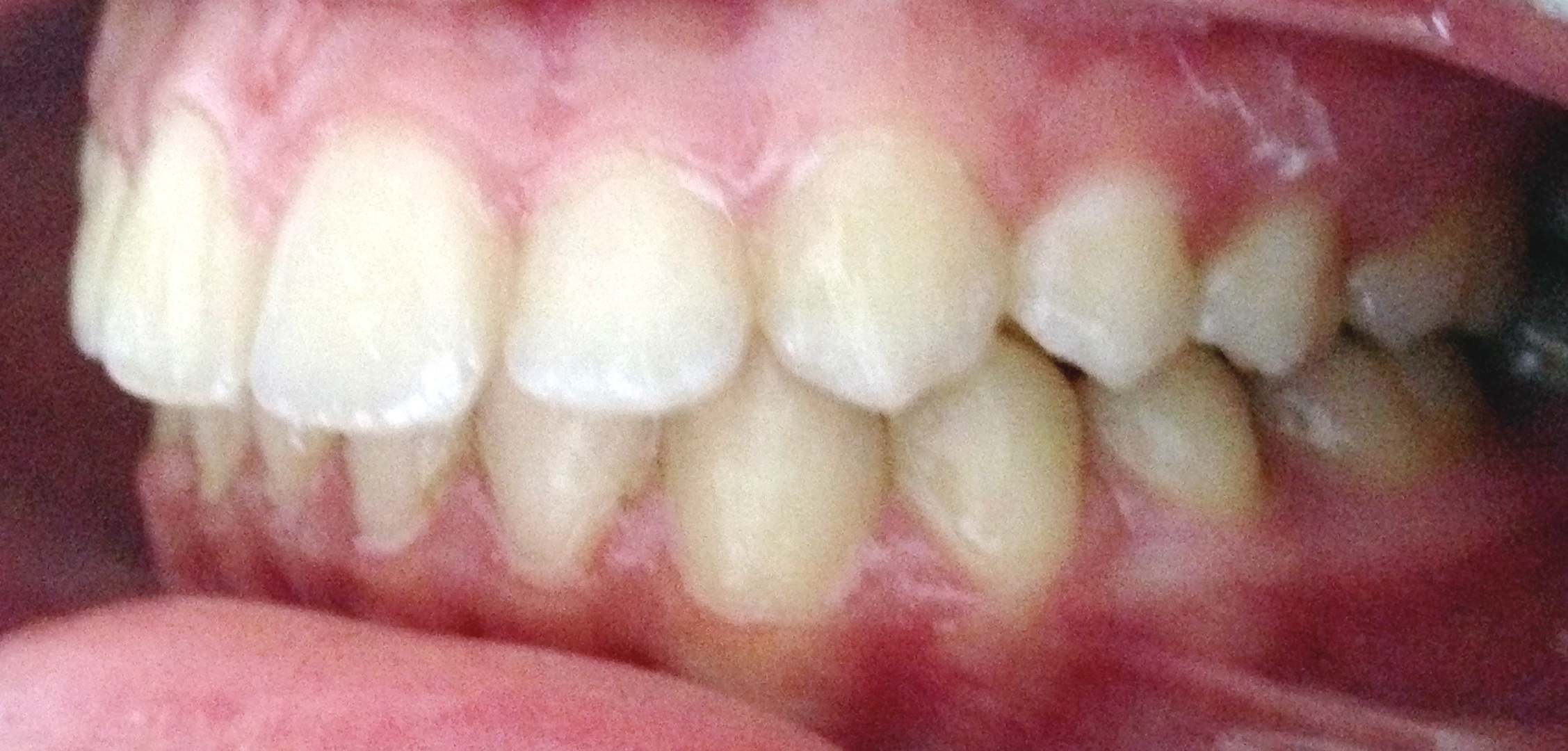 second image