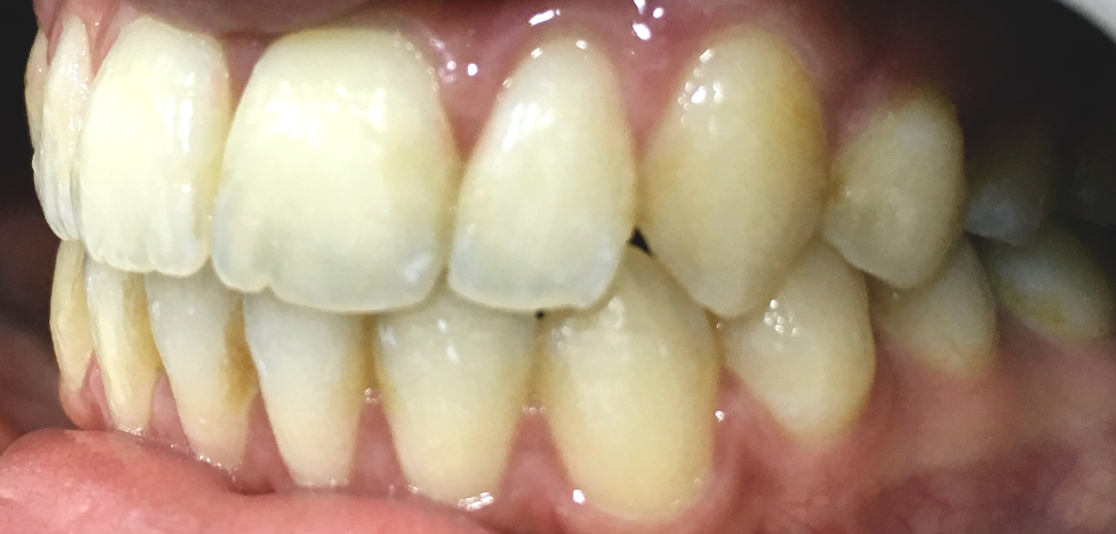 second image
