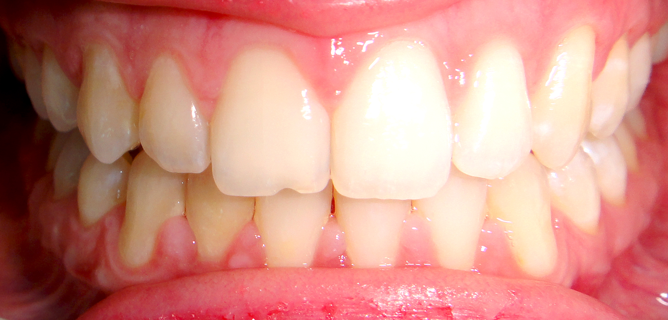 second image
