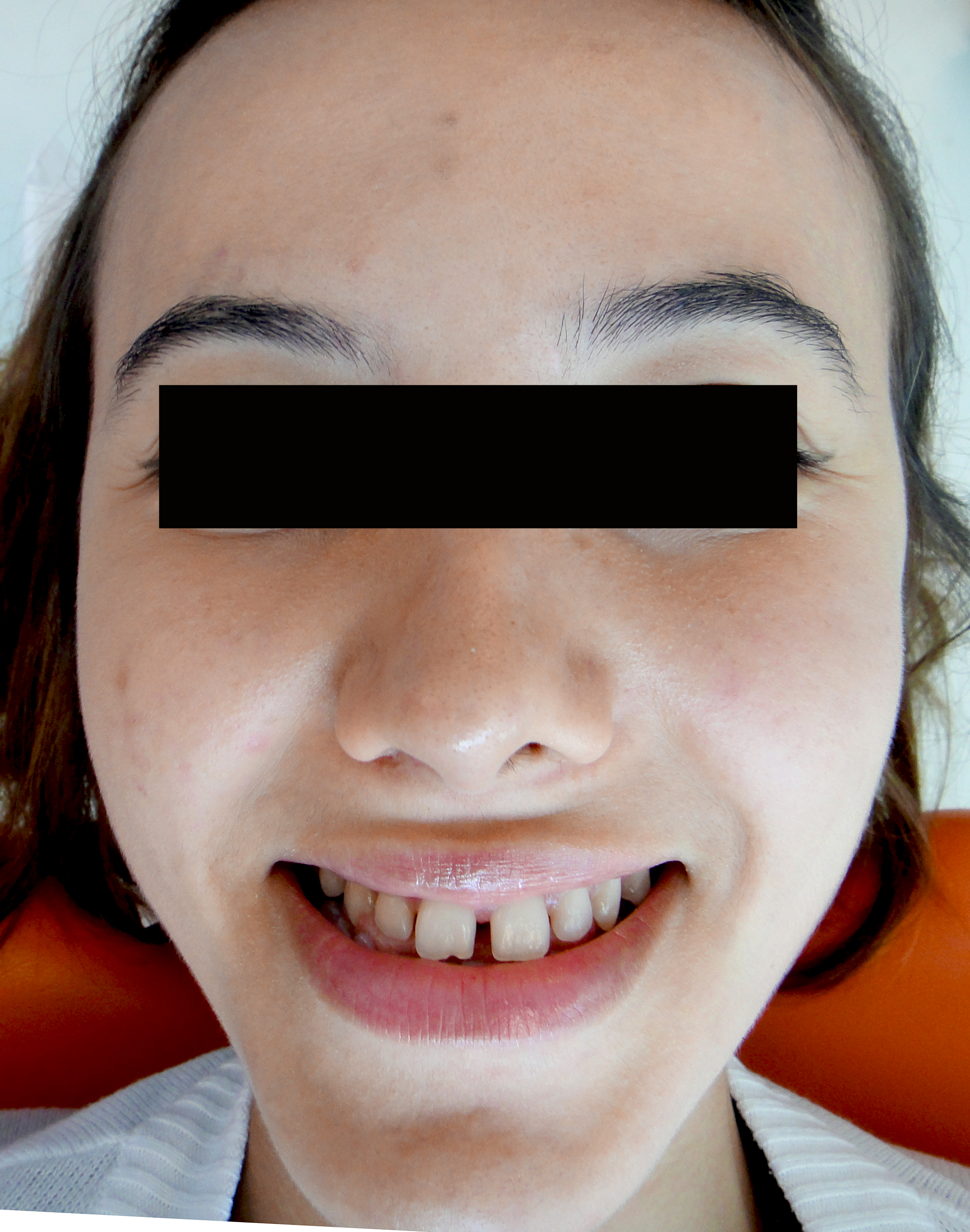 first image