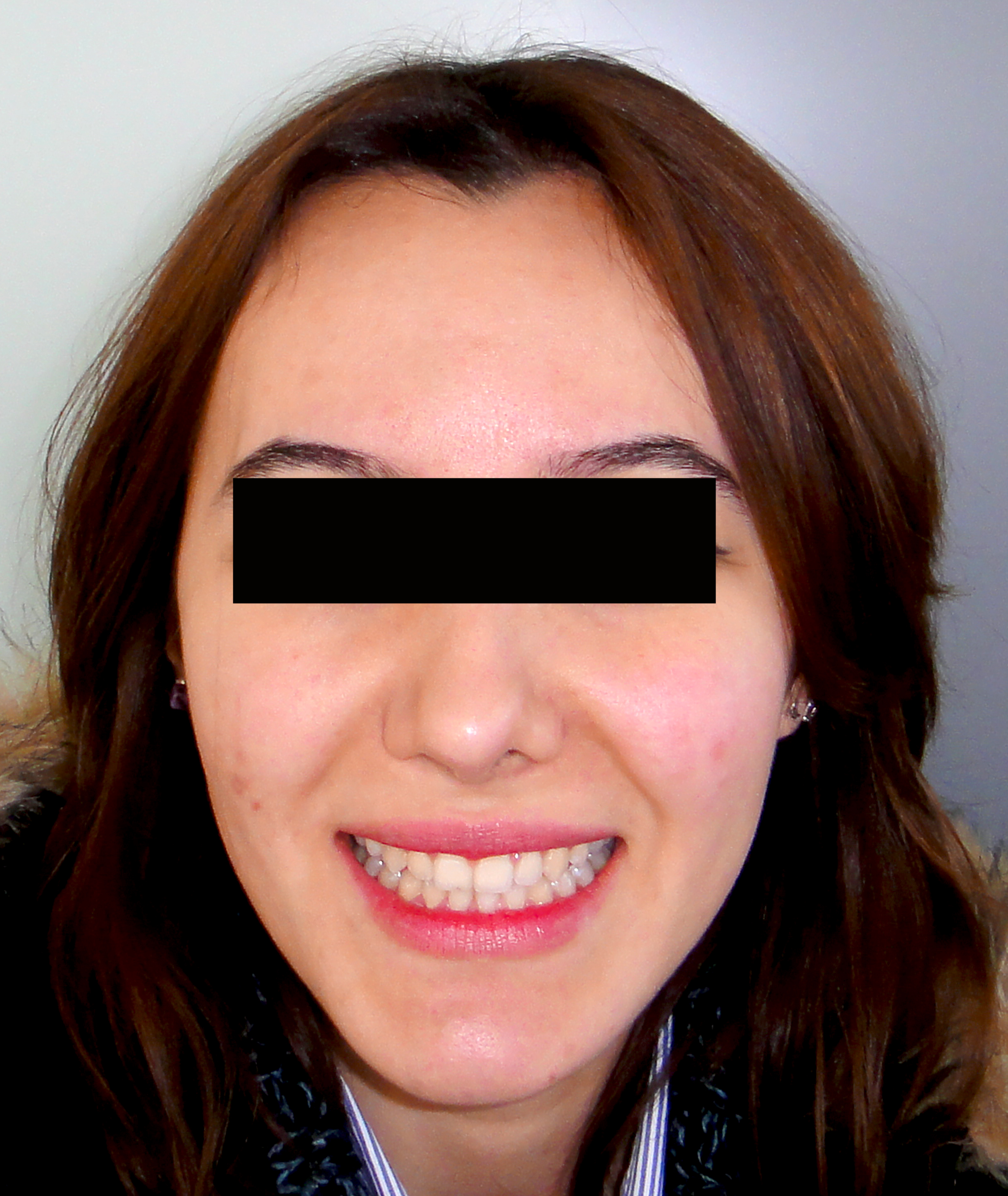 second image