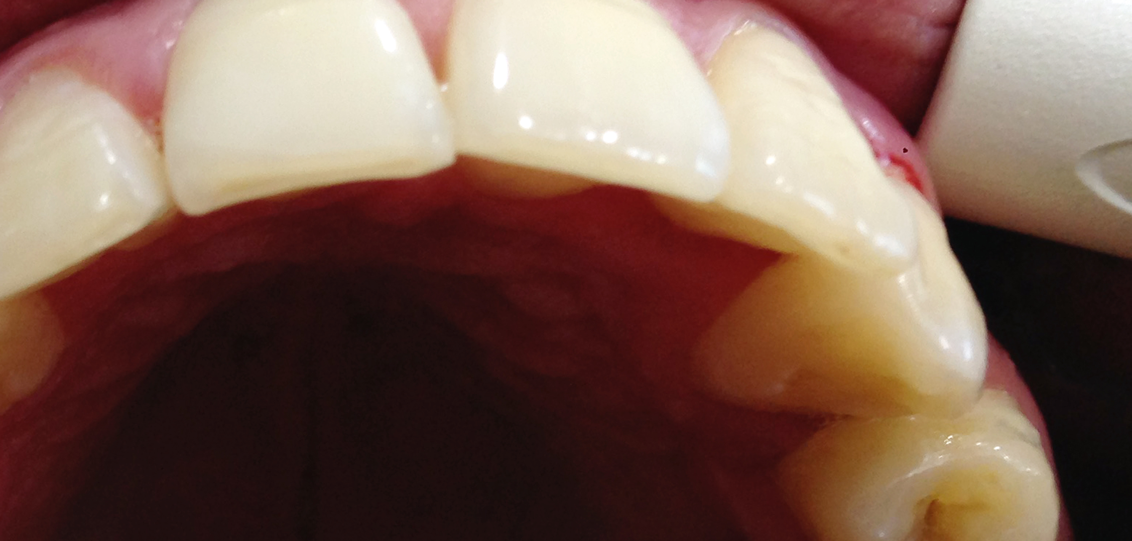 second image